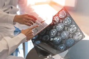 Médicos avaliam exame de câncer.
